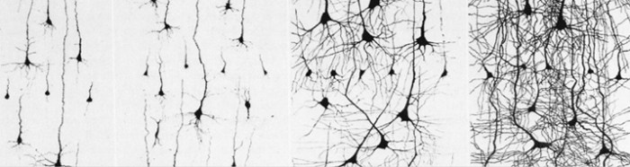 neuroplasticity-banner-77f6a688022811b36d894b9288bd49f3